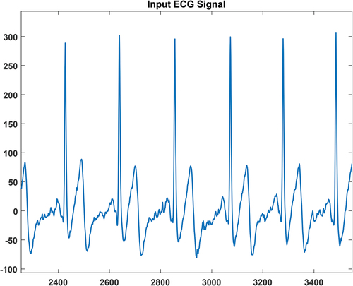 Figure 4. ECG Input Signal.