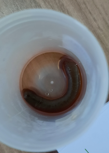 Figure 2. Leech (6 cm) after endoscopic removal with forceps.
