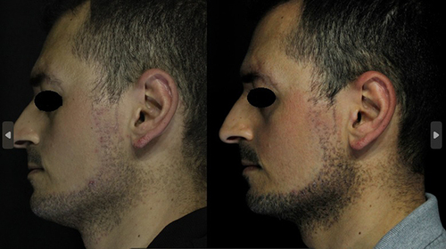 Figure 2 Left side of face.