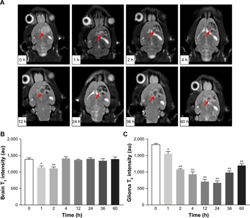 Figure 6 In vivo MRI efficacy.Notes: T2-weighted MR images of glioma-bearing Wistar rats at different times after tail vein injection of SPIO@DSPE-PEG/DOX/ICG NPs (A); arrow indicates direction of the glioma. The quantitative analyses of the T2 value in brain (B) and tumor (C). Data are mean ± SD, n=3, *P<0.05 and **P<0.01 vs 0 hours.Abbreviations: DOX, doxorubicin; DSPE-PEG, 1,2-distearoyl-sn-glycero-3-phosphoethanolamine-N-[methoxy(polyethylene glycol)]; ICG, indocyanine green; MRI, magnetic resonance imaging; SPIO NPs, superparamagnetic iron oxide nanoparticles.