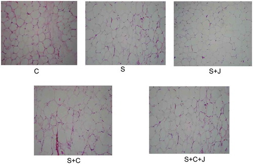 Figure 6. Histological analysis of abdominal adipose tissue in control and experimental groups. Control group (C) fed with a standard diet and water ad libitum; S group fed with a standard diet and plus 30% sucrose in drinking water (S); S + J group fed with high-carbohydrate diet and administrated with blackberry juice processed with microwaves and ultrasound 4.2 mL/kg, S + C group fed with standard diet, 30% sucrose in drinking water and cholesterol 1 g/kg and administrated with blackberry juice processed with microwaves and ultrasound 4.2 mL/kg (S + C + J). Non-processed blackberry juice was not tested.Figura 6. Análisis histológico del tejido adiposo abdominal del grupo control y experimental. Grupo experimental: Grupo experimental: Grupo control (C) alimentado con una dieta estándar y agua ad libitum; grupo alimentado con una dieta estándar y con sacarosa al 30% (S); grupo alimentado con sacarosa al 30% y administrado con jugo de zarzamora procesado con microondas y ultrasonido 4.2 mL/kg (S + J), grupo alimentado con dieta estándar, sacarosa al 30% y colesterol (1 g/kg, S + C) y un grupo administrado con dieta estándar, sacarosa al 30%, colesterol (1 g/kg) y jugo de zarzamora procesado con microondas y ultrasonido 4.2 mL/kg (S + C + J). El jugo de zarzamora sin tratar no fue incluido en el estudio