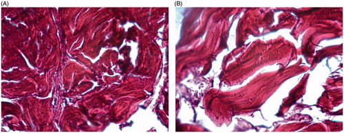 Figures 4. (A) High levels of collagen replacement on penile muscle structure (Control Group). (B) Low levels of collagen replacement on penile muscle structure (Testosterone replacement group). Colored by picrosirius, 40×.