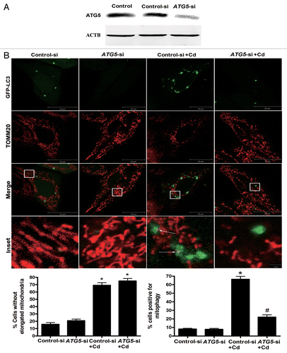 Figure 4A and B.ATG5 siRNA treatment reverses mitochondrial loss by inhibiting mitophagy. (A) A representative immunoblot of ATG5 protein levels (55 kDa) in L02 cells following ATG5 silencing using a commercial vector. ACTB (42 kDa) was the internal standard for protein loading. (B) The colocalization of GFP-LC3 with TOMM20 was determined in L02 cells to visualize the mitochondria-containing AP formations. Red: TOMM20, green: GFP-LC3, orange-yellow: Merge. The orange-yellow puncta were counted as mitochondria-containing APs. A minimum of 50 cells were analyzed for each experiment.