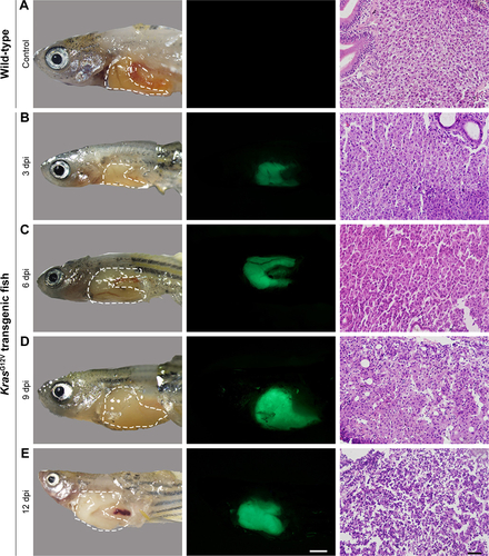 Figure S6 Tumorigenesis of hepatocellular carcinoma in doxycycline-treated krasG12V zebrafish.Notes: (A–E) Bright-field (left column), green fluorescent protein fluorescence (middle column), and H&E staining images of livers (right column) in (A) wild-type (control) and (B–E) krasG12V zebrafish at (B) 3 dpi, (C) 6 dpi, (D) 9 dpi, and (E) 12 dpi. Scale bar: 500 µm (middle column); 20 µm (right column).Abbreviation: dpi, days post induction.