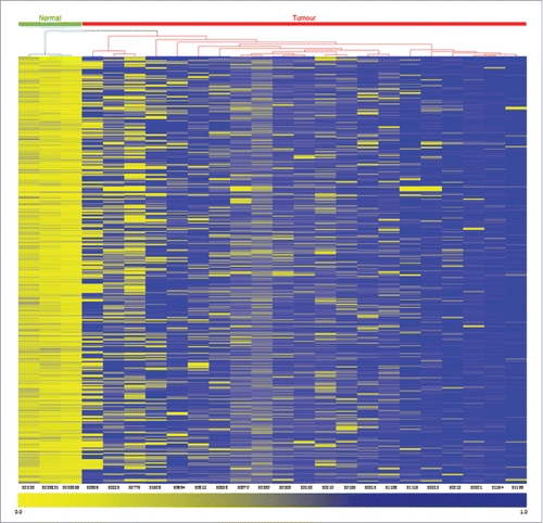 Figure 2. Unsupervised hierarchical clustering analysis of the 1,057 gene promoter-associated hypermethylated CpGs in HG-NMIBC. Heatmap and dendrogram of differentially methylated gene promoter-associated CpG sites identified by array analysis. The dendrogram above the heatmap separates normal bladder (green bar, n = 3) and high-grade-NMIBC bladder tumors (red bar, n = 21). Each row represents an individual CpG locus, and each column represents a normal control or tumor sample (listed beneath the heatmap). The color scale beneath the heatmap represents methylation status: unmethylated is yellow (β-value = 0.0), and fully methylated is blue (β-value = 1.0).