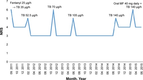 Figure 1 Pain intensity and TB doses in a patient diagnosed with chondrosarcoma of the sacral bone.