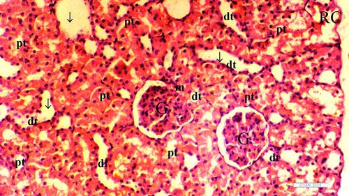 Figure 6 Representative light microscopy of kidney tissue from the dexmedetomidine group.