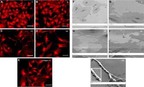 Figure 7 Morphology of primary rat podocytes.Notes: Representative (A–E) Dil staining and (F–J) SEM images of rat podocytes after 5 days of culture on nanopatterned silicon and collagen-coated plastic. Rat podocytes did not attach to uncoated plastic or to unpatterned silicon. Acobblestone morphology is observed when cells are seeded on the rough surfaces (A) F and (B, F, G) N, whereas cells grown on (C) FEand (D, H, I, J) NEporous materials present elongated shape and are provided with ramifications, similar to cells grown on (E) collagen-coated plastic. (J) The morphology of a podocyte ramification extending from the cell body and adhering on the porous surface NE can be better observed by SEM at higher magnification. (A–E) Scale bars =50 μm.Abbreviations: Dil, 1′-dioctadecyl-3,3,3′,3′-tetramethylindocarbocyanine perchlorate; SEM, scanning electron microscopy.