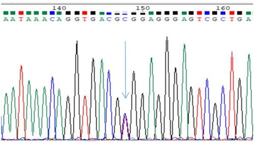 Figure 4 Heterozygote CT sequencing map, blue and red double peaks indicated by arrow (location 148).