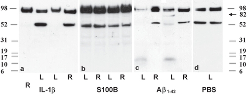 Figure 3 Western blotting of APP in retinas injected with (a) IL-1β, (b) S100B, (c) Aβ1–42 peptide, and (d) PBS 2 days after injection. Each panel shows 2 animals per treatment. Both IL-1β and Aβ1–42 show a marked reduction in APP levels in the injected left eye (L) compared with the noninjected right eye (R), particularly in the 54 kDa band. There was no down-regulation after injection with S100B or PBS. Note also the appearance of bands around 13 kDa and 82 Kda after injection with Aβ1–42.