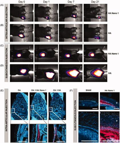 Figure 3. Cartilage persistence of conventional HA and thermosensitive HA Nano 1 conjugated with cyanine 5. In vivo imaging system showed the retention of HA and HA Nano 1 after (A, B) intra-articular injection in an OA mouse model and (C, D) subcutaneous injection in healthy mice (n = 4). (E) Fluorescence micrographs of right knee 2 months after OA induction (F: femur, T: tibia, scale bar = 300 µm). (F) Fluorescence micrographs of the skin at 21 days after injection (D: Dermis, scale bar = 500 µm), and mice received an injection of PBS as the sham group. Reprinted with permission from Maudens et al. (Citation2018).