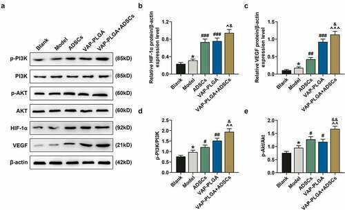 Figure 9. VAP-PLGA enhanced the promoting effect of adipose-derived stem cells (ADSCs) on the activation of PI3K/Akt/HIF-1α signaling pathway and VEGF expression in chronic skin ulcers in vivo. (a) Western blot analysis indicated the protein levels of p-PI3K, PI3K, p-Akt, Akt, HIF-1α, and VEGF in the blank, model, ADSCs, VAP-PLGA, and VAP-PLGA +ADSCs groups on the 28th day after treatment. (b) Relative protein level of HIF-1α. (c) Relative protein level of VEGF. (d) The ratio of p-PI3K to total PI3K protein (p-PI3K/PI3K) in the blank, model, ADSCs, VAP-PLGA, and VAP-PLGA +ADSCs groups. (e) The ratio of p-Akt to total Akt protein (p-Akt/Akt) in the blank, model, ADSCs, VAP-PLGA, and VAP-PLGA +ADSCs groups. β-actin was used as an internal control. The average data from three independent experiments were shown as mean ± standard deviation. *p < 0.05 vs. Blank; #p < 0.05 or ##p < 0.01 or ###p < 0.001 vs. Model; ^p < 0.05 or ^^p < 0.01 or ^^^p < 0.001 vs. ADSCs; &p < 0.05 or &&p < 0.01 vs. VAP-PLGA