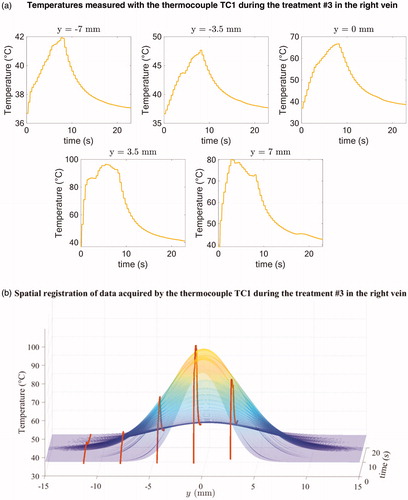 Figure 4. Illustration of temperature profiles measured by the thermocouple TC1 during the treatment #3 in the right vein for each of the y-locations before spatial registration (a) and example of spatial registration of the data acquired by the thermocouple TC1 during the treatment #3 (b).