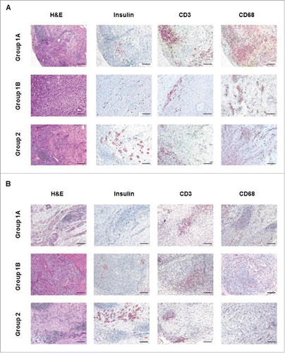 Figure 6. Comparison of histopathological examination in Groups 1 and 2 (A). Histopathological examination of islet allografts at biopsy (2 weeks after transplantation) of sections stained with hematoxylin and eosin (H&E, left columns), immunostained for insulin (second columns panels), CD3 cells (third column), and CD68 cells (right column). While Group1A or Group1B insulin-positive islets were fragmented, Group2 grafts showed preserved islet morphology. Cell infiltration was observed in H&E staining in biopsies from all groups, and most of the infiltrating cells were positive for CD3. CD68-positive cell infiltration was possibly more intensive in the Group1A pigs. (B) Histopathological examination of islet allografts at necropsy was performed 4 weeks after transplantation. While Group1A or Group1B insulin-positive islets were fragmented, Group2 grafts showed preserved islet morphology. Scale bars: 50μm.