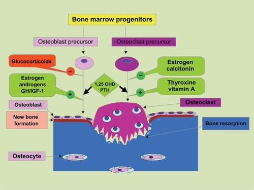 Figure 2 Development of osteoblasts and osteoclasts from bone marrow progenitors. Factors affecting the development and function of these cells, bone resorption by osteoclast, and new bone formation by osteoblasts. Copyright © 2006. Reproduced with permission from Valsamis et al; licensee BioMed Central Ltd. Alsamis HA, et al. Antiepileptic drugs and bone metabolism. Nutr Metab. 2006;3:36. doi:10.1186/1743-7075-3-36.Citation71