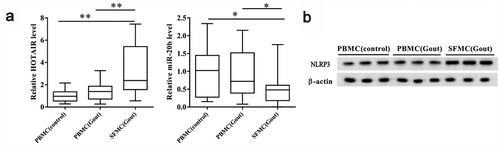 Figure 1. LncRNA HOTAIR, miR-20b, and Nlrp3 expression levels in SFMCs from patients with acute gouty arthritis. Samples were collected from patients with acute gouty arthritis (n = 15) and healthy controls (n = 10), for which peripheral blood and synovial samples were collected from patients with acute gouty arthritis and peripheral blood samples were collected from healthy controls. PBMCs were isolated from peripheral blood, and SFMCs were isolated from synovial samples. A. Compared with PBMC (control) and PBMC (Gout) groups, lncRNA HOTAIR expression was up-regulated in the SFMC (Gout) group, whereas miR-20b expression was down-regulated in the SFMC (Gout) group. There were no significant changes in lncRNA HOTAIR and miR-20b expressions between PBMC (control) and PBMC (Gout) groups. B. Western blot showed that the NLRP3 protein level was up-regulated in SFMC (Gout) group than PBMC (control) and PBMC (Gout) groups. *P< 0.05, compared with PBMC (control) or PBMC (Gout)