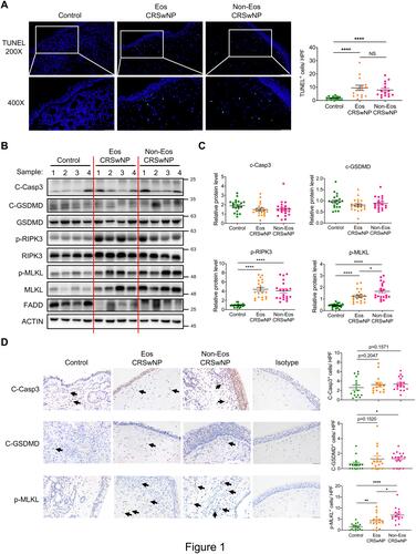 Figure 1 Prominent necroptosis is associated with CRSwNP. (A) TUNEL staining of control tissues and nasal polyps (Eos, Eosinophilic; Non-Eos, Non-eosinophilic). TUNEL positive cells were counted over high power field (400×) (n=15 per group). Scale bars: 200×, 100 μm; 400×, 50 μm. (B and C) Immunoblots and quantification of the protein levels over actin in control tissues and nasal polyps (n=20 per group). (D) IHC staining of cleaved caspase-3 (C-Casp3), cleaved gasdermin D (C-GSDMD) and p-MLKL in control tissues and nasal polyps. The positive cells were counted over high power field (400×) (n=15 per group). Scale bars: 50 μm. The data were shown as mean±SEM. NS, not significant; *p<0.05, **p<0.01, ****p<0.0001; by Mann–Whitney U 2-tailed test.