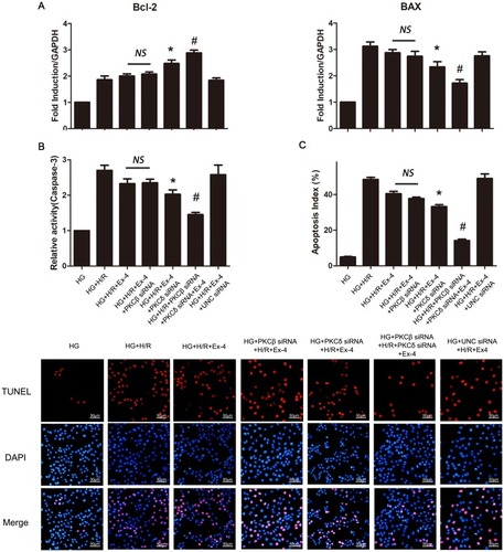 Figure 7 Knockdown of both PKCβ and PKCδ restored anti-apoptotic effects of GLP-1 analog significantly in H9C2 cells cultured by high glucose. (A) QRT-PCR analysis of Bcl-2 and BAX mRNA. (B) Caspase-3 activity analysis. (C) Representative images of TUNEL staining and corresponding apoptosis index. *P<0.05 vs HG + H/R + Ex-4 group, HG + H/R + Ex-4 + PKCβ siRNA + PKCδ siRNA group and HG + H/R + Ex-4 + UNC siRNA group. #P<0.01 vs HG + H/R + Ex-4 group and HG + H/R + Ex-4 + UNC siRNA group.