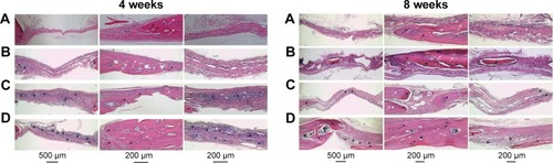 Figure 13 Histological sections (H&E staining) of rat cranial defect and surrounding tissue at different testing times.Abbreviations: BMC, biomimetic mineralized collagen; NMC, non-mineralized collagen; TMC, traditional mineralized collagen; H&E, hematoxylin and eosin.