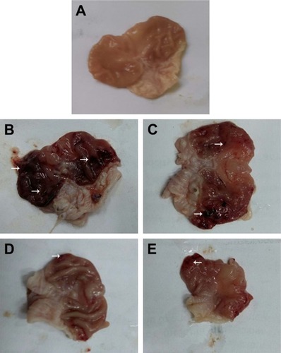 Figure 6 Gross appearance of stomach tissues.Notes: (A) Normal control with normal gastric mucosa, (B) positive control showing multiple gastric ulcers and intensely hemorrhagic mucosa, (C) rats pretreated with naringin (100 mg/kg) displaying some gastric ulcers and moderately hemorrhagic mucosa, and rats pretreated with either (D) naringin (200 mg/kg) or (E) naringin–PF68 micelles (100 mg/kg) showing minimal gastric ulcers and mildly hemorrhagic mucosa. Arrows indicate gastric ulcers and hemorrhagic mucosa.Abbreviation: PF68, pluronic F68.
