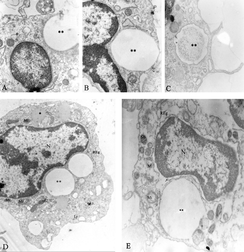 FIG. 4 Phagocytose of PLGA-microparticle loaded with psoralen A by macrophage peritoneal exudate. (A) PLGA microparticle (**) interacting with cellular membrane in the process of phagocytosis (15 min incubation). (B) Phagosome with PLGA microparticle (30 min incubation). (C) Psoralen A after microparticle digestion by macrophage (120 min incubation). (D) PLGA microparticle inside the macrophage cell, without irradiation (incubated for 120 min), mitochondria-Mi, lysosomes-Ly, nucleus (N), and granular endoplasmatic reticulum-Reg. (E) Photo-damage (PUVA) in macrophage cell with microparticle after 120 min incubation: cytoplasmic vesiculation, mitochondria condensation (Mi), and a swelling of granular endoplasmatic reticulum (Reg) and nuclear membrane (arrow) (12000×).