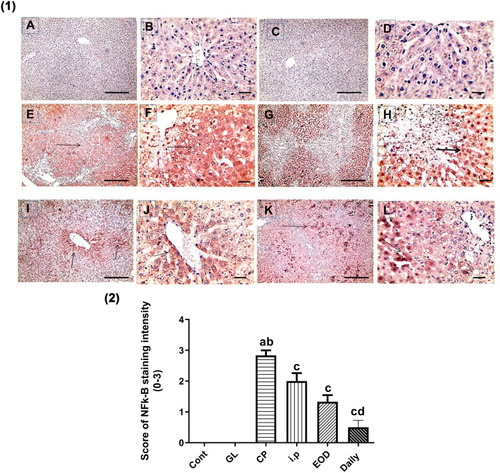 Figure 9 Effect of Ganoderma lucidum on immunoexpression of NF-kB in rat livers. (1) Representative microscopic pictures of liver sections immunostained using NF-kB antibody, showing negative nuclear staining score (0) in the control group (A and B) and GL group (C and D). Strong positive nuclear staining as indicated by intense brown color score (3) in CP group (E and F), moderate positive nuclear staining score (2) in i.p treated group (G and H), mild positive nuclear staining score (1) in EOD group (I and J), and very mild positive nuclear staining score ±1 in daily group (K and L). Black arrows point to positive nuclear staining. IHC counterstained with Mayer’s hematoxylin. X: 100 bar 100 (A, C, E, G, I, and K) and X: 400 bar 50 (B, D, F, H, J, and L). (2) Statistical analysis of IHC staining intensity scores in six experimental groups showing significant reduction in NF-kB in daily group when compared with CP group. Different small alphabetical letters means significant when P< 0.05. aSignificant against control group; bsignificant against GL group; csignificant against CP group; dsignificant against i.p group.