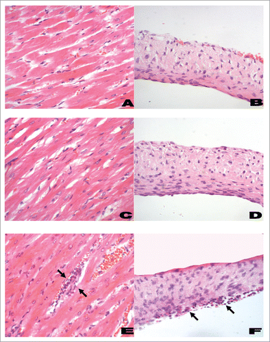 Figure 5. Histological features of myocardium (left panel) and heart valves (right panel) from Lewis rats. A representative histological section from rats immunized with PBS and adjuvant (negative control; A and B) had little or no infiltration of inflammatory cells into the myocardium or valvular tissue. Rats immunized with J8-DT (C and D) had minimal changes comparable to the negative control rats. However, in rM5-immunized rats (positive control; E and F) there was evidence of mononuclear cell infiltration (Arrows) in the myocardial and valvular tissue (H&E; original magnifications: A, C and E, x200; B, D and F, x400). The rat hearts were excised and fixed in 10% neutral buffered formalin for 48 h prior to being embedded in paraffin. Tissue samples were cut in 5 µm-thick sections on a microtome and stained with hematoxylin and eosin (H&E) using standard procedures. Sections were examined by a pathologist who was blinded to the treatment groups, using a light microscope fitted with a QImaging camera. Evidence of inflammatory changes and cellular infiltration in the myocardium and mitral, aortic and tricuspid valve leaflets were assessed.