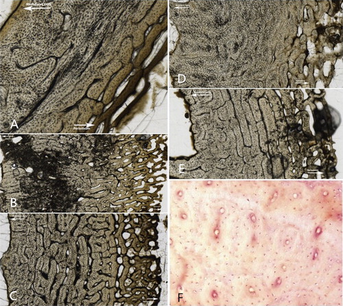 Figure 1. Descriptions of the Oxford Histological Index (OHI) and examples from the sectioned specimens in this study. (A) No original features identifiable, other than Haversian canals (Index 0); (B) small areas of well-preserved bone present, or some lamellar structure preserved by pattern of destructive foci (Index 1); (C) clear lamellate structure preserved between destructive foci (Index 2); (D) clear preservation of some osteocyte lacunae (Index 3); (E) only minor amounts of destructive foci, otherwise generally well preserved (Index 4); (F) Very well-preserved, virtually indistinguishable from fresh bone (Index 5) (Source: Mescher AL: Junqueira’s Basic Histology: Text and Atlas 12th Edition: http://www.accessmedicine.com Copyright© The McGraw-Hill Companies, Inc. All rights reserved).