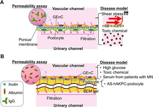 Figure 6 Summary of the permeability assay: basically, the pathologic stimuli were applied from the vascular channel. All or part of the fluorescently labeled inulin, albumin, and IgG were infiltrated into the urinary channel from the capillary channel to evaluate the selective permeability of the filtration barrier (A and B). (A) Permeability assay in the device has two layers with porous membrane: in the diseased model, doxorubicin-induced nephrotic syndrome and hypertensive glomerulopathy with exposure to high shear stress hyper-perfusion. (B) Permeability assay in bilateral flow with central gel channels device: experimental conditions to mimic clinical pathophysiology were as follows: Toxic chemicals with puromycin aminonucleoside, high glucose, and serum from patients with membranous nephropathy exposure for the drug-induced nephrotic syndrome, diabetic nephropathy, and immunological glomerulopathy. The Alport syndrome-human kidney progenitor cells derived from the amniotic fluid-podocyte were used to demonstrate the hereditary glomerulopathy model.