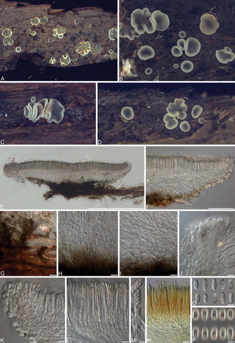 Fig. 10 Phialocephala aylmerensis. A–D. Apothecia on decaying Betula papyrifera wood. E, F. Vertical sections of apothecia. G. Subicular hyphae. H, I. Ectal excipulum cells near base (H) and toward flanks (I). J, K Marginal cells. L. Asci and paraphyses. M. Mature ascus containing ascospores. N. Asci with hemiamyloid tips in Lugol’s solution after KOH pretreatment. O. Ascospores under DIC. P. Ascospores under phase contrast. Bars: E = 500 μm, F = 100 μm, G–L, N = 10 μm, M, O, P = 5 μm.