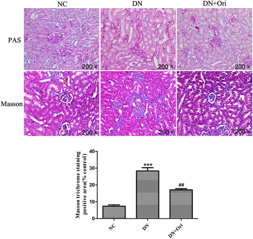 Figure 3. Effects of Ori on renal pathological changes in diabetic rats.PAS and MT staining of kidney tissues. **p < 0.01 vs. the NC group, ###p < 0.001 vs. the DN group. PAS: periodic acid-Schiff; MT: Masson’s trichrome; NC: normal control; DN: diabetic nephropathy; DN + Ori: diabetic nephropathy + oridonin.