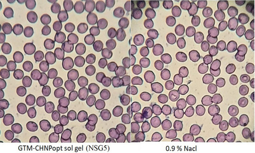 Figure 8 Isotonicity image of treated blood with optimized gentamycin chitosan nanoparticles sol-gel (GTM-CHNPopt sol-gel, NSG5) and control (0.9% NaCl).