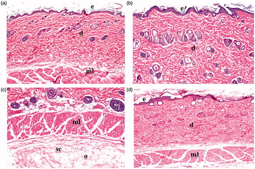 Figure 9. Light micrographs of rat skin untreated (a). Light micrographs of rat skin treated with standard irritant (b). Light micrographs of rat skin treated with standard irritant (c). Light micrographs of rat skin treated with optimized lacidipine proniosomal gel formulation (d).