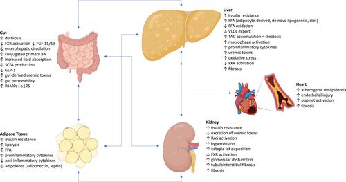 Figure 1 Role of a Gut-AT-Liver-Kidney Axis Leading to NAFLD and CKD. The pathogenesis of NAFLD and CKD have many shared causes including dysregulation and dysfunction of the gut and adipose tissue, chronic inflammation, atherogenic dyslipidemia, and proinflammatory cytokines and hepatokines. The primary feature of hepatic steatosis occurs when there is an imbalance of FFA leading to excess lipid droplets containing TAGs which are the storage form for FFAs in the hepatocytes. In the steady state, the concentration of TAGs in the liver is kept low by balancing the trafficking of FFAs into and out of the liver, production of FFAs by hepatocytes, consumption of FFAs by mitochondrial beta-oxidation, and TAG export from the liver as VLDL particles. The glucose uptake receptors in adipose tissue are dependent on insulin. Thus, insulin resistance leads to decreased glucose uptake and increased serum glucose concentrations, which then promotes insulin production by the pancreatic beta cells. Dysregulation of adipose tissue leads to increased lipolysis and secretion of FFAs, and this is the primary source of FFAs to the liver contributing to steatosis. Activation of macrophages in adipose tissue leads to secretion of cytokines and chemokines and further drives insulin resistance. FXR expression is downregulated by the systemic inflammation, and the altered microbiome increases conversion of primary BAs to secondary BAs, which lowers the concentration of the more potent activator of FXR and subsequently suppresses the pathways that increase GLP-1 expression, inhibit lipolysis in the adipose tissue, decrease de novo lipogenesis in the liver, and increase FFA oxidation in the liver, muscle, and adipose tissue. Activation of the renin-angiotensin-aldosterone system leads to increased production of angiotensin II and uric acid. Gut-derived uremic toxins (indole, p-cresol, trimethylamine, ammonia) increase oxidative stress and proinflammatory cytokines which further propagates gut permeability and translocation of PAMPs. Once CKD has developed, there is decreased excretion of the uremic toxins. The gut-derived toxins are shuttled to the liver where they are oxidized or conjugated into nephrotoxic compounds. Kupffer cell activation with cytokine release results in macrophage differentiation with proinflammatory and fibrogenic functions. Thus, all these aforementioned processes cumulatively activate inflammatory, oxidative, and fibrotic pathways in the kidney, liver, and heart.