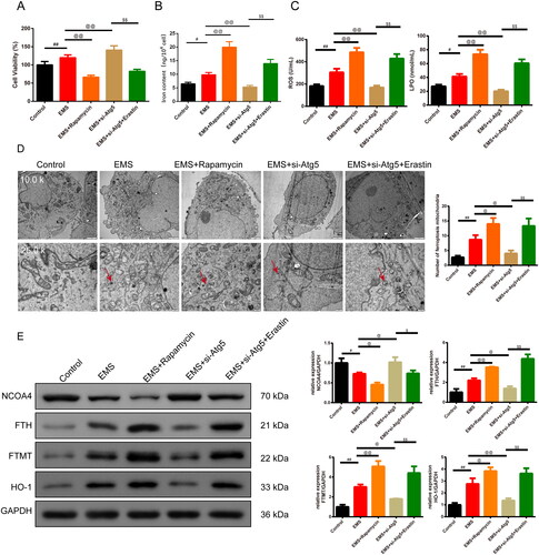 Figure 3. Ferroptosis is closely related to autophagy in EMS cells. (A) CCK8 was used to test the cell viability of each group of cells. n = 6 in each group. (B) Iron content of the cells was detected by the kit. n = 3 in each group. (C) ELISA kits were used to test the expression of the ROS and LPO of cells in each group. n = 3 in each group. (D) Transmission electron microscopy was used to observe the morphological changes of mitochondria (magnification 10.0k×, scale bar: 2 μm; magnification 25.0k×, scale bar: 500 nm) and the number of the mitochondria was recorded in the chart. n = 3 in each group. (E) Expression of NCOA4, FTH, FTMT, and HO-1 was evaluated by western blot assay, and GAPDH was used as the internal control. n = 3 in each group. #p < .05 and ##p < .01 vs. control group. @p < .05 and @@p < .01 vs. EMS group. $p < .05 and $$p < .01 vs. EMS + si-Atg5 group. EMS: endometriosis; CCK8: cell counting kit-8; HE: hematoxylin and eosin; ELISA: enzyme-linked immunosorbent assay; ROS: reactive oxygen species; LPO: lipid peroxide; NCOA4: Nuclear Receptor Coactivator 4; FTH: ferritin heavy chain; FTMT: ferritin mitochondrial; HO-1: heme oxygenase-1.