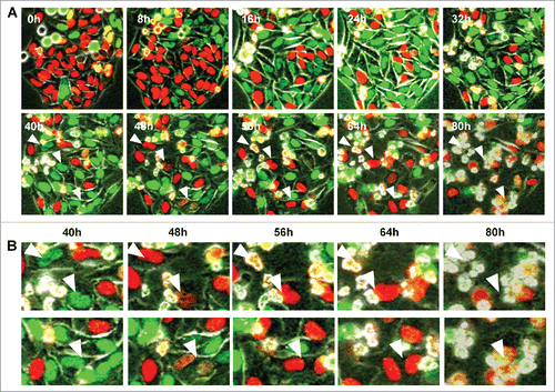 Figure 4. Prolonged administration of rMETase induced mitotic catastrophe after late S/G2 phase blocking. (A) Time-lapse imaging of HeLa-FUCCI cells treated with rMETase. After seeding on 35 mm glass dishes and culture overnight, HeLa-FUCCI cells were treated with rMETase at a dose of 1.0 unit/ml for 80 hours. All images were acquired with the FV1000 confocal microscope (Olympus, Tokyo, Japan). The cells in G0/G1, S, or G2/M phases appear red, yellow, or green, respectively. (B) High magnificent image of A. Arrowheads refer to a cell dying from mitotic catastrophe.