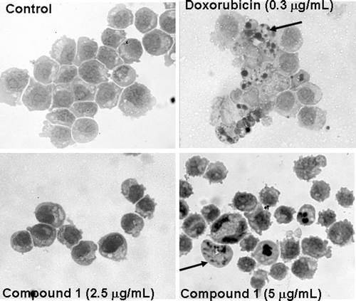 Figure 2.  Cucurbitacin 1 induced morphological changes in HL-60 leukemia cells. A – Control cells; B – Cells treated with doxorubicin at 0.3 µg/mL; C and D – Cells treated with compound 1 at 2.5 and 5.0 µg/mL. Black arrows – nuclear fragments showing a periphery of compacted chromatin.