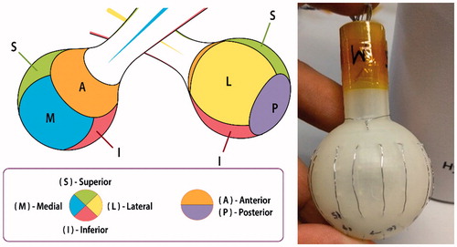 Figure 3. RFA device design with six faces, each corresponding to a clinical margin (left). Prototype with 4 electrodes per face and ring electrode at anterior face (right).