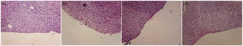 Figure 6. Nasal histopathological images of (a) negative control. (b) QTF simple dispersion. (c) QTF liposomal dispersion. (d) Positive control.