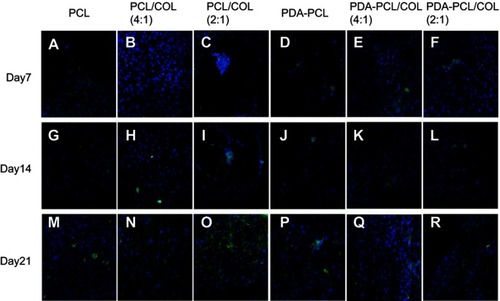 Figure 9 Col1a2 expression using immunofluorescent staining assay. (A, G, M) TSPCs cultured on PCL for day7, day14, day21. (B, H, N) TSPCs cultured on PCL/COL (4:1) for day7, day14, day21. (C, I, O) TSPCs cultured on PCL/COL (2:1) for day7, day14, day21. (D,J,P) TSPCs cultured on PDA-coated PCL for day7, day14, day21. (E, K, Q) TSPCs cultured on PDA-coated PCL/COL (4:1) for day7, day14, day21. (F, L, R) TSPCs cultured on PDA-coated PCL/COL (2:1) for day7, day14, day21, scale bars: 50 µm.Abbreviations: TSPCs, tendon stem/progenitor cells; PCL, polycaprolactone; COL, collagen; PDA, poly(dopamine); Col1a2, collagen I alpha 2.