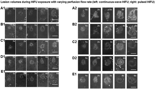 Figure 3. Gross observation of HIFU ablation effects with different portal vein perfusion rates. (a) (A1-E1) Continuous-wave HIFU with no perfusion (A1) and with perfusion rates of 100 mL/min (B1), 200 mL/min (C1), 400 mL/min (D1) and 800 mL/min (E). (b) (A2-E2) Pulsed-HIFU with no perfusion (A2) and with perfusion rates of 100 mL/min (B2), 200 mL/min (C2), 400 mL/min (D2) and 800 mL/min (F2). Scale bar, 10 mm.