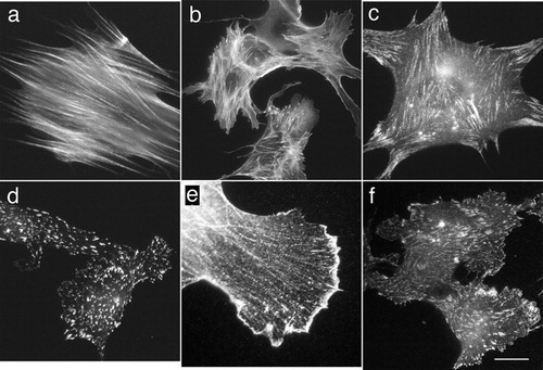 Figure 4. Fluorescence micrographs of microwave-assisted fixation and immunofluorescent staining. Fixed human foreskin fibroblasts (a, c, and e) and bovine endothelial cells (b, d, and f) were stained with anti-actin (a and b), anti-vinculin (c and d), anti-alpha-actinin (e), or anti-talin (f) antibody for 5 minutes, and then with fluorescent-labeled secondary antibodies for 5 minutes with intermittent microwave irradiation. In both fibroblasts and endothelial cells, immunoreactivity with anti-actin antibody was observed along the actin-containing microfilament bundles called stress fibers (a and b). Anti-vinculin staining was observed in a punctate pattern, reflecting cell-to-substrate adhesion sites in both fibroblastic and endothelial cells (c and d). Anti-alpha-actinin staining was colocalized with stress fibers (e). Anti-talin staining was also localized to focal adhesion sites in bovine endothelial cells (f). Bar = 20 μm.