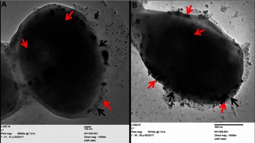 Figure 12 Ultrastructure alteration in C. albicans after treatment with 25 and 50 µg/mLof ScAgNPs. The red arrows indicate attachment and internalization of AgNPs, whereas black arrows represent damage to the integrity of the cell wall and cytoplasmic membrane after treatment with AgNPs.Abbreviation: ScAgNPs, Syzygium cumini silver nanoparticles.