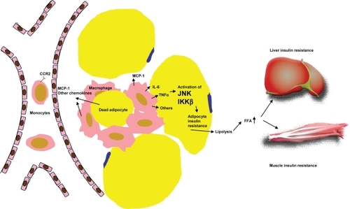 Figure 1 Mechanism of adipose macrophage infiltration and the role of adipose inflammation in systemic insulin resistance. Accumulation of triglycerides in adipocytes causes increased production of MCP-1 and the other monocyte chemotactic factors, which attract circulating monocytes to migrate into adipose tissue. These inflamed monocytes mature into classically activated macrophages and secrete a variety of proinflammatory factors that can impair insulin signaling in adipocytes. Dysregulated adipocyte lipolysis contributes to elevation of circulating FFA level which subsequently induces insulin resistance in other tissues such as liver and muscle.