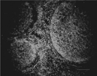 Figure 5 The EGFP-expressing MSCs (green) mainly accumulated around the injured nerve fiber stem (100 ×).