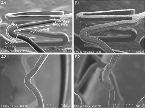 Figure 1 Scanning electron microscope images of sirolimus-coated stents with AGC stent (A) and CFC stent (B).