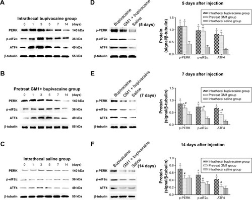 Figure 7 Western blotting showing levels of p-PERK, p-eIF2α, and ATF4 protein levels at six time points (A–C). Comparing the expression of proteins among three groups on days 5, 7, and 14 (D–F) and quantifying by densitometric analysis.