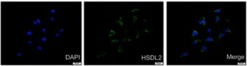 Figure 2 IF staining of HSDL2 in MDA-MB-231 breast cancer cells.Notes: HSDL2 protein is mainly located in the cytoplasm of MDA-MB-231 cells. (Blue for DAPI, green for HSDL2).