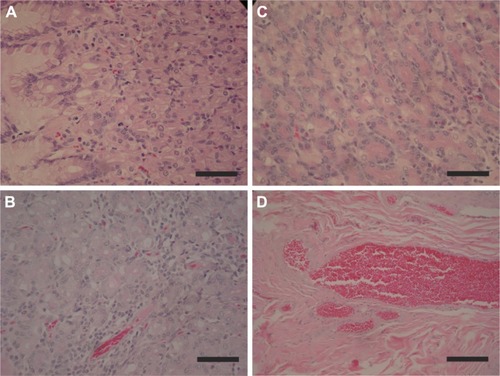 Figure 4 Results of histopathological analysis of the stomach. (A) NC – normal mucosa showing mucoid cells, parietal and chief, and scattered vascular congestion. (B) LDE-PTX175 – normal mucosa showing mucoid cells, parietal and chief, and scattered vascular congestion. (C) LDE-PTX250 – normal mucosa showing mucoid cells, parietal and chief, presenting pervasion by some inflammatory mononuclear cells. (D) LDE-PTX250 – presence of intense vascular congestion in the submucosa. Magnification is 400×, and scale bar represents 50 μm.Abbreviations: NC, negative control; LDE, cholesterol-rich nanoemulsion; PTX, paclitaxel.