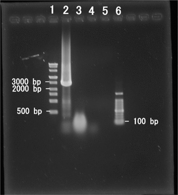 Figure 1. Fragmentation of DNA in samples autoclaved with encapsulation.All samples were diluted with equal amounts of TE after processing, and 3 µL of each was loaded: the original sample of the 2682 bp PCR product (lane 2); samples processed at 121°C for 20 min (lane 3), 40 min (lane 4), and 120 min (lane 5). Novagen 0.5–12 kb Perfect DNA Markers (lane 1) (Merck KGaA, Darmstadt, Germany) and 100 bp DNA Ladder Markers (lane 6) (Takara) were loaded as references. The lowest markers in lanes 1 and 6 are 500 bp and 100 bp, respectively.